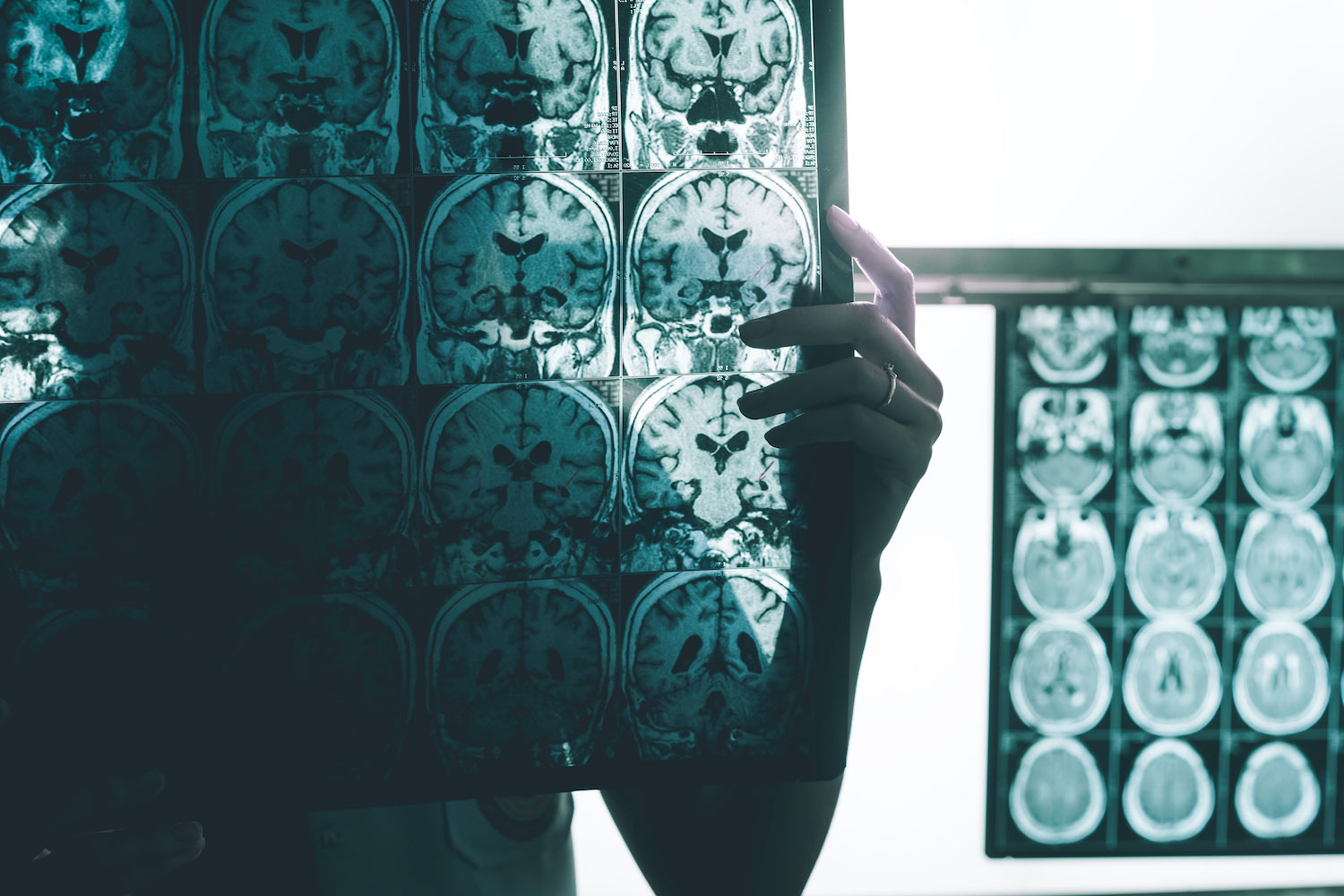 Woman holding scans of brain